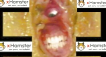 Medicinska sestra sex uradci stavlja ogledalo u pacijentovu maca